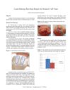 Load-Sharing Rip-Stop Repair for Rotator Cuff Tears