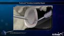 PushLock® Knotless Instability Repair