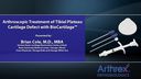 Arthroscopic Treatment of Tibial Plateau Cartilage Defect with BioCartilage™